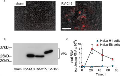 Rhinovirus C Infection Induces Type 2 Innate Lymphoid Cell Expansion and Eosinophilic Airway Inflammation